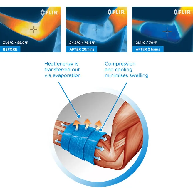 CoolXChange Compression and Cooling Gel Bandage Recovery Ice Wrap
